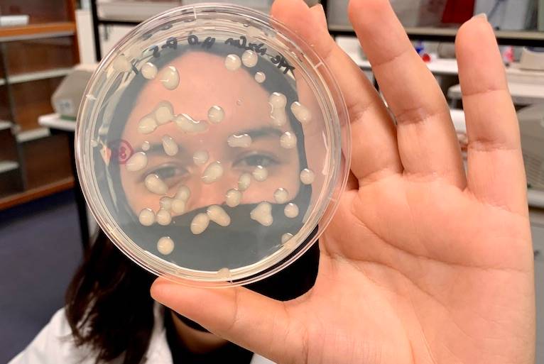 CSIRO teams up with Murdoch Uni for $8 million Bioplastics Innovation Hub developing compostable plastics 